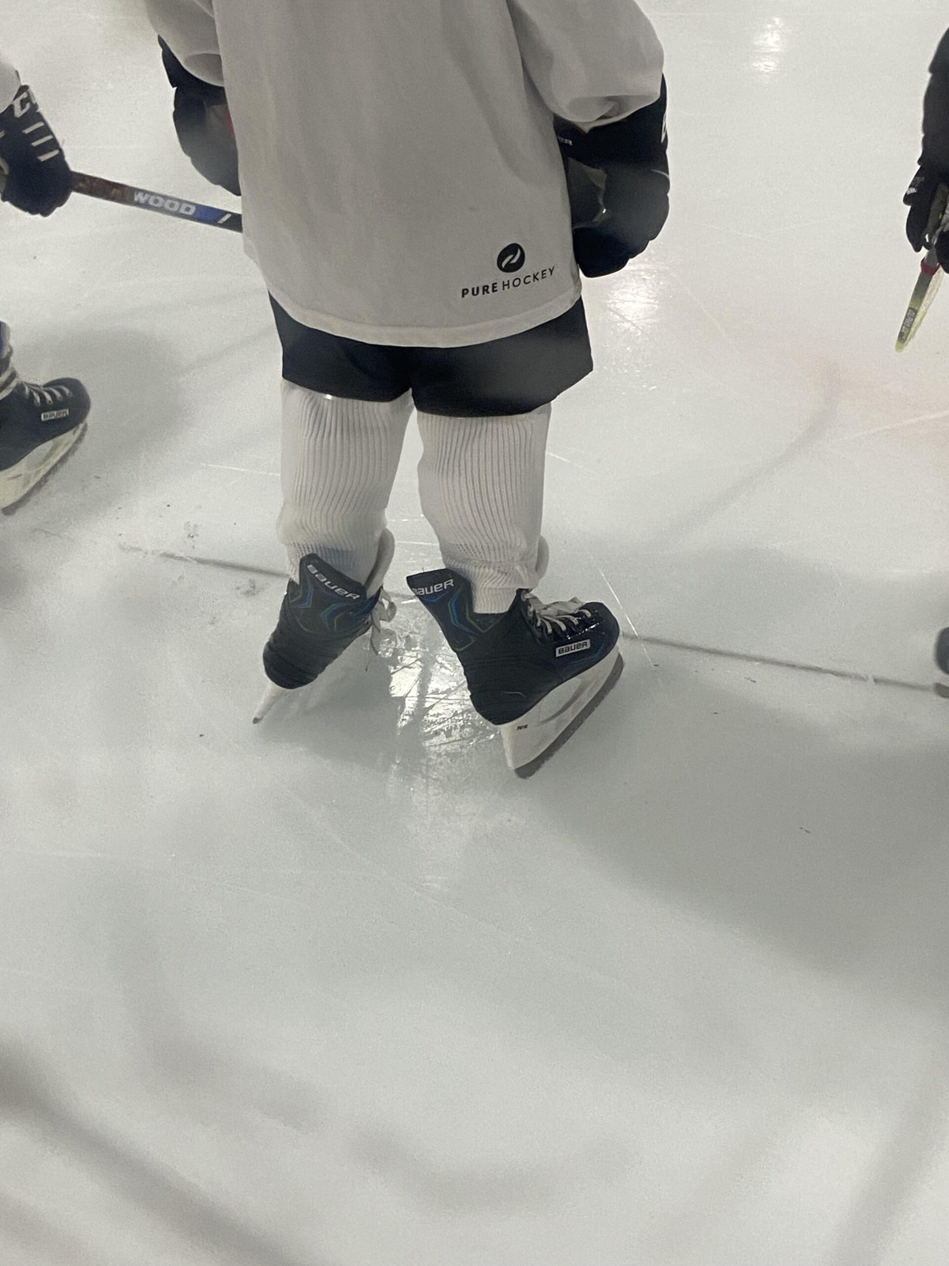 Are Ice Skates Supposed to Fit Your Feet Tightly?